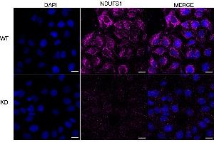 Immunocytochemical staining of HeLa cells using NDUFS1 antibody (ABIN7799555), 1:1,000), Top panel: wild-type (WT), Bottom panal: NDUFS1 shRNA knockdown (KD).