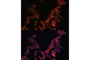 Immunofluorescence analysis of L929 cells using MT-ND4 antibody (ABIN7268602) at dilution of 1:100. (Mitochondrially Encoded NADH Dehydrogenase 4 (MT-ND4) antibody)