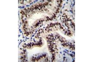Immunohistochemistry analysis in formalin fixed and paraffin embedded human uterus tissue reacted with HNRNPCL1 Antibody (C-term) followed by peroxidase conjugation of the secondary antibody and DAB staining. (HNRNPCL1 antibody  (C-Term))