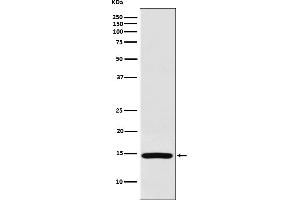 Western blot analysis of RPS19 expression in HeLa cell lysate.
