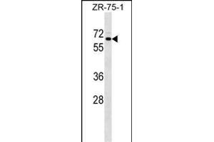 SRPR Antibody (C-term) (ABIN1537353 and ABIN2849199) western blot analysis in ZR-75-1 cell line lysates (35 μg/lane). (SRPR antibody  (C-Term))