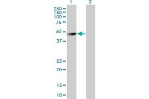 Western Blot analysis of GIF expression in transfected 293T cell line by GIF MaxPab polyclonal antibody. (Intrinsic Factor antibody  (AA 1-417))
