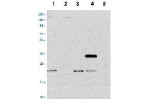Western blot analysis of Lane 1: RT-4, Lane 2: U-251 MG, Lane 3: Human Plasma, Lane 4: Liver, Lane 5: Tonsil with PTCD2 polyclonal antibody .