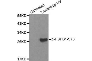 Western blot analysis of extracts from HL60 cells, using Phospho-HSPB1-S78 antibody. (HSP27 antibody  (pSer78))