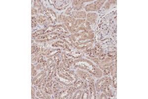 Immunohistochemical analysis of B on paraffin-embedded Human kidney tissue. (RPL23A antibody  (C-Term))