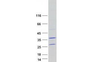 Western Blotting (WB) image for TatD DNase Domain Containing 1 (TATDN1) protein (Myc-DYKDDDDK Tag) (ABIN2733248)