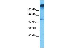 Host:  Rabbit  Target Name:  WDR7  Sample Type:  COLO205 Whole Cell lysates  Antibody Dilution:  1. (WDR7 antibody  (C-Term))