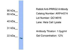 WB Suggested Anti-PRRG2  Antibody Titration: 0. (PRRG2 antibody  (Middle Region))