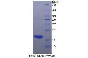 SDS-PAGE analysis of Horse Inhibin beta A Protein.