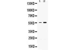 Western blot analysis of MEF2A expression in rat thymus extract ( Lane 1) and HELA whole cell lysates ( Lane 2). (MEF2A antibody  (C-Term))