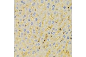Immunohistochemistry of paraffin-embedded Mouse liver using PCM1 antibody at dilution of 1:100 (x400 lens).