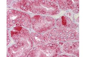 Anti-AMACR antibody IHC of human kidney. (AMACR antibody  (AA 286-335))