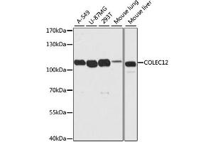Western blot analysis of extracts of various cell lines, using COLEC12 antibody (ABIN4903342) at 1:2000 dilution. (COLEC12 antibody)