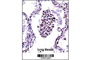 NFKBIB Antibody immunohistochemistry analysis in formalin fixed and paraffin embedded human lung tissue followed by peroxidase conjugation of the secondary antibody and DAB staining. (NFKBIB antibody  (C-Term))