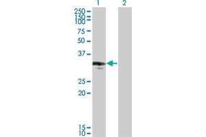 Western Blot analysis of CENPP expression in transfected 293T cell line by CENPP monoclonal antibody (M07), clone 3G8. (CENPP antibody  (AA 1-98))