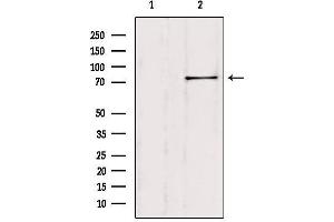 Western blot analysis of extracts from Hela, using SH2B1 Antibody. (SH2B1 antibody  (Internal Region))