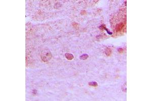 Immunohistochemical analysis of PMS1 staining in human brain formalin fixed paraffin embedded tissue section. (PMS1 antibody  (Center))