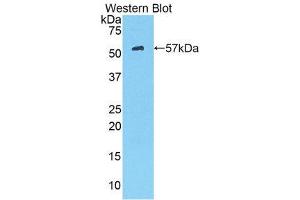 Western Blotting (WB) image for anti-Hexokinase 2 (HK2) (AA 605-868) antibody (ABIN3204499)