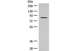 Western blot analysis of Mouse brain tissue lysate using PFKM Polyclonal Antibody at dilution of 1:350 (PFKM antibody)