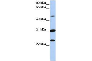 WB Suggested Anti-XK Antibody Titration:  0. (Membrane transport protein XK (XK) (N-Term) antibody)