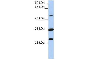 WB Suggested Anti-XK Antibody Titration:  0.