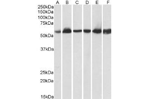 Western Blotting (WB) image for anti-Heat Shock 60kDa Protein 1 (Chaperonin) (HSPD1) (AA 333-344) antibody (ABIN5539538)