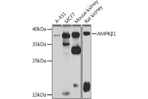 Western blot analysis of extracts of various cell lines, using AMPKβ1 antibody (ABIN6134216, ABIN6146175, ABIN6146177 and ABIN6223916) at 1:1000 dilution. (PRKAB1 antibody)