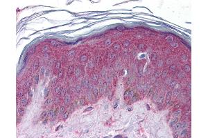 Immunohistochemistry (IHC) image for anti-APC Regulator of WNT Signaling Pathway 2 (APC2) (Middle Region) antibody (ABIN2784219) (APC2 antibody  (Middle Region))