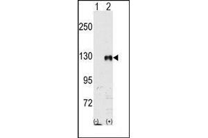 Western blot analysis of EphB1 (arrow) using rabbit polyclonal EphB1 Antibody.