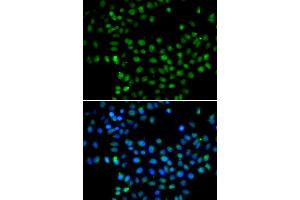 Immunofluorescence analysis of A549 cells using EAF2 antibody (ABIN5974281). (EAF2 antibody)