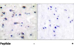 Immunohistochemical analysis of paraffin-embedded human brain tissue using OPRM1 polyclonal antibody . (Mu Opioid Receptor 1 antibody)