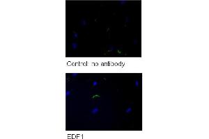 WB Suggested Anti-GPD1 Antibody    Titration: 5 ug/ml   Positive Control: HG (EDF1 antibody  (N-Term))