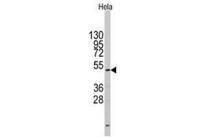 Image no. 1 for anti-CD4 (CD4) (N-Term) antibody (ABIN357033) (CD4 antibody  (N-Term))