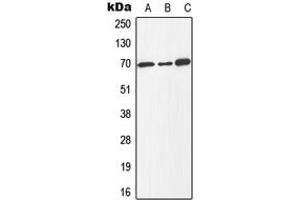 Western blot analysis of E2F1 (pT433) expression in Jurkat colchicine-treated (A), mouse spleen (B), PC12 colchicine-treated (C) whole cell lysates. (E2F1 antibody  (C-Term, pSer433))