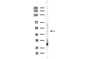 anti-Arrestin Domain Containing 4 (ARRDC4) (Internal Region) antibody