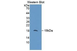 Detection of Recombinant NUTF2, Human using Polyclonal Antibody to Nuclear Transport Factor 2 (NUTF2) (NUTF2 antibody  (AA 1-127))