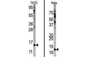 Image no. 1 for anti-Finkel-Biskis-Reilly Murine Sarcoma Virus (FBR-MuSV) Ubiquitously Expressed (FAU) (Center) antibody (ABIN357137) (FAU antibody  (Center))