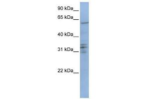 CENPB antibody used at 1 ug/ml to detect target protein. (CENPB antibody  (C-Term))