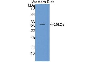 Western Blotting (WB) image for anti-GATA Binding Protein 1 (Globin Transcription Factor 1) (GATA1) (AA 150-384) antibody (ABIN1980403) (GATA1 antibody  (AA 150-384))