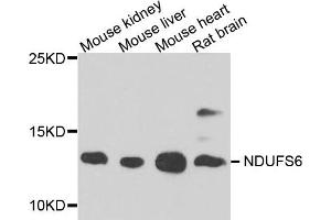 Western blot analysis of extract of various cells, using NDUFS6 antibody. (NDUFS6 antibody)