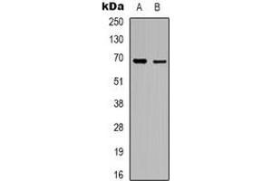 Western blot analysis of RhoBTB3 expression in A10 (A), K562 (B) whole cell lysates. (RHOBTB3 antibody)