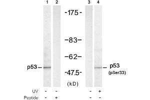 Image no. 1 for anti-Tumor Protein P53 (TP53) (Ser33) antibody (ABIN319305) (p53 antibody  (Ser33))