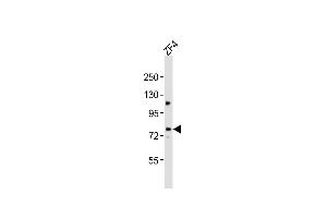 Anti-mtm1 Antibody (C-Term)at 1:2000 dilution + ZF4 whole cell lysates Lysates/proteins at 20 μg per lane.