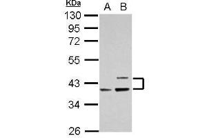 WB Image Sample (30 ug of whole cell lysate) A: Raji B: K562 10% SDS PAGE antibody diluted at 1:1000 (APOL1 antibody)