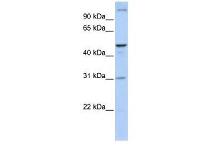 ACBD5 antibody used at 1 ug/ml to detect target protein. (ACBD5 antibody  (N-Term))
