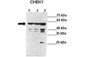 Lanes : Lane 1: 40ug SH-SY5Y lysateLane 2: 40ug SH-SY5Y lysateLane 3: 40ug HEK293T lysate  Primary Antibody Dilution :  1:1000   Secondary Antibody : Anti-rabbit-HRP  Secondary Antibody Dilution :  1:8000  Gene Name : CHEK1  Submitted by : Anonymous (CHEK1 antibody  (Middle Region))