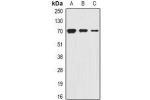 Western blot analysis of PiT2 expression in HepG2 (A), mouse kidney (B), rat liver (C) whole cell lysates.