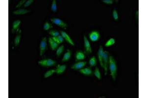 Immunofluorescent analysis of Hela cells using ABIN7156293 at dilution of 1:100 and Alexa Fluor 488-congugated AffiniPure Goat Anti-Rabbit IgG(H+L) (ITPR1 antibody  (AA 1707-1966))