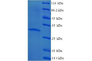 SDS-PAGE (SDS) image for Yippee-Like 3 (YPEL3) (AA 1-119), (full length) protein (His-SUMO Tag) (ABIN4974334)