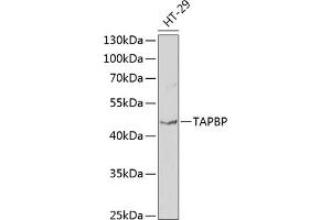 Western blot analysis of extracts of HT-29 cells, using TAPBP antibody (ABIN6132745, ABIN6148848, ABIN6148850 and ABIN6219122) at 1:1000 dilution. (TAPBP antibody  (AA 30-260))